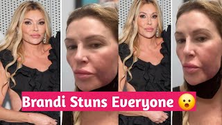 RHOBH Brandi Glanville showed off her disfigured face in a shocking new photo claiming Bravo [upl. by Htor446]