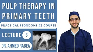 Lecture 03  Pulp Therapy in Primary Teeth  Pulpotomy vs Pulpectomy  كورس بيدو عملي [upl. by Prochora641]