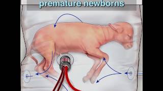 Artificial womb could help save preborn children [upl. by Anitram]