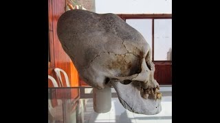 Newly Discovered Elongated Skulls In Paracas Peru [upl. by Megdal]