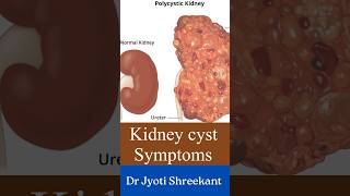 Kidney cyst symptoms shorts [upl. by Drhcir]