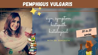 pemphigus vulgaris I oral pathology lectures [upl. by Conrad]