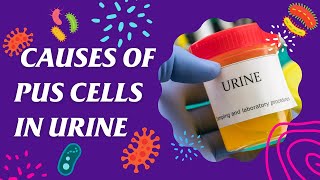 pus cells rbc bacteria in urine uti patient [upl. by Hartill]