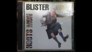 Blister  Hoots Mon Full Album [upl. by Lussi]