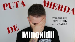 9º Meses con MINOXIDIL PUTA MIERDA DE MINOXIDIL [upl. by Naeruat]