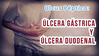 ÚLCERA GÁSTRICA Y DUODENAL Definición causas Diagnóstico diferencial y Tratamiento [upl. by Ninette834]