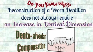 Dentoalveolar CompensationDo you knowWhen does an Increase in Vertical Dimension not Required [upl. by Rotow165]