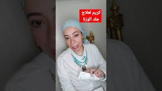 كريم لعلاج جلد الوزه ✔ [upl. by Adlay]