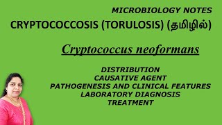 Cryptococcosis Torulosis  Cryptococcus neoformans  pathogenesis lab diagnosis treatment Tamil [upl. by Nehtan]