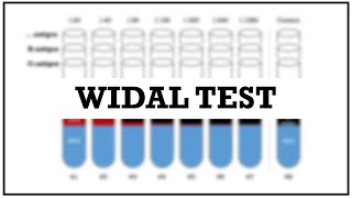 Widal test  Introduction amp procedure [upl. by Grossman]