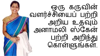 ஒரு கருவின் வளர்ச்சியைப் பற்றி அறிய உதவும் அனாமலி ஸ்கேன் பற்றி அறிந்து கொள்ளுங்கள் [upl. by Nosmas]