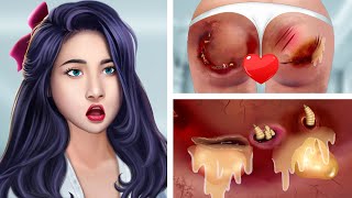 ASMR Treat infected wounds on the buttocks amp Remove dog ticks  Deep Cleaning Animation [upl. by Barvick]