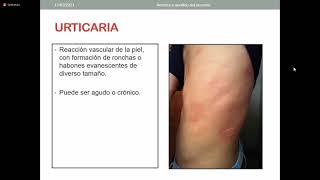 Urticaria Angiedema y Eritema Multiforme  Medicina III [upl. by Datnow]