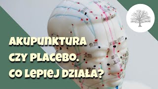 Czy akupunktura działa Badania naukowe [upl. by Dulcia]