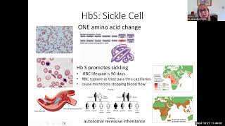 hbio14c RBC related disorders 21 min [upl. by Hseham911]