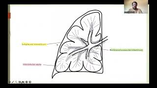 Reticular opacities part 2 English version [upl. by Carlson939]