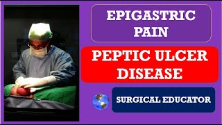 PEPTIC ULCER DISEASE How To DIAGNOSE amp TREAT EPIGASTRIC PAIN [upl. by Myrwyn]