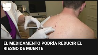 Desarrollan una vacuna experimental contra el melanoma un cáncer de piel que puede ser mortal [upl. by Groark]