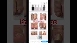 unghie incarnite onicomicosi newmusic manicure pedicure salonandspa damianodavid maneskin [upl. by Isolde]