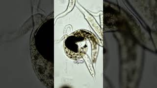 Dois protozoários caçadores disputam a mesma presa microbiologia microorganismos [upl. by Nosae830]