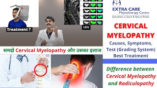 Cervical Myelopathy Physiotherapy Treatment  Causes Symptoms Test amp Grading  NO SURGERY NEEDED [upl. by Torp]