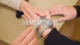 Thumb Arthritis Symptoms Causes and Treatment [upl. by Perice]