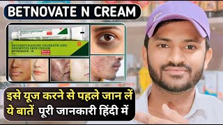 Betnovate n cream uses benefits and side effects full review in hindi [upl. by Enihpesoj]