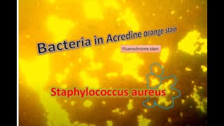 Staphylococcus aureus under Fluorescence microscopy [upl. by Gnat244]