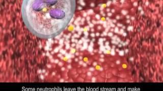 Immune Response to Bacteria [upl. by Terhune628]