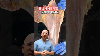 Runner’s Knee Pain Fix 🏃‍♂️ shorts [upl. by Pages]