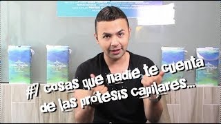 PROTESIS CAPILAR 7 COSAS QUE NADIE TE DICE [upl. by Olds]