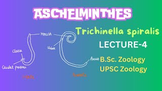 Aschelminthes  Trichinella spiralis Parasitic helminthes  Zoology  Notes in Description [upl. by Narag]