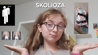 SKOLIOZA [upl. by Acyre]