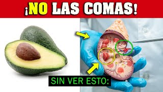 ¡ALERTA quienes NO DEBERÍAN Comer AGUACATE 🥑 Palta ⛔ [upl. by Wrench485]