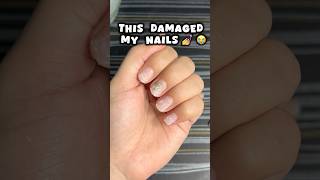 Nail extensions ki galti 😭😭nails nailsextension viralvideo shortsfeed viralshort trending [upl. by Namref304]