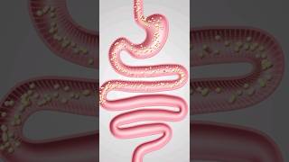 How to Detox Your Intestines [upl. by Lucille468]