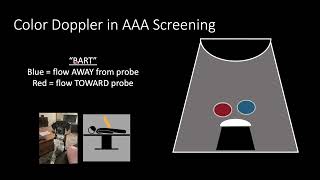 POCUS for Abdominal Aortic Aneurysm and Aortic Dissection [upl. by Yrahca780]