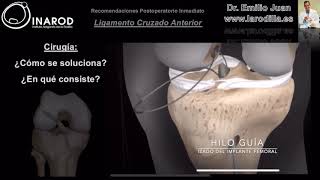 Ligamento Cruzado Anterior Cirugía y Recuperación Postoperatoria [upl. by Enawd]