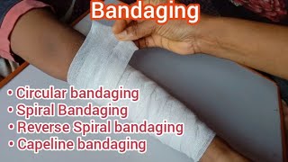 Bandaging and its Types  Capeline bandaging Circular bandaging Spiral bandaging Reverse Spiral [upl. by Sacks]