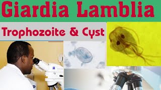 Giardia Lamblia Cyst amp Trophozoite [upl. by Leina]