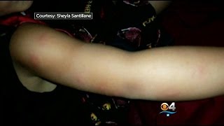 Moviegoers Claim Bed Bugs Bit Them At Hollywood Theater [upl. by Eniak311]