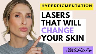 The Best Laser Treatments for Hyperpigmentation  Dr Sam Ellis [upl. by Tenrag333]