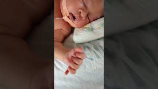 polydactyly music love bollywood nicu [upl. by Golda]