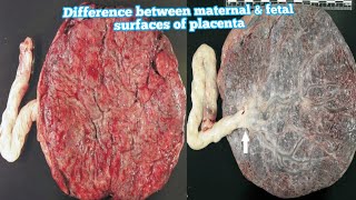 Difference between maternal amp fetal surfaces of placenta in hindihow to identify them placenta [upl. by Stark]