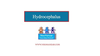 Hydrocephalus Preterm Infant [upl. by Zoa564]