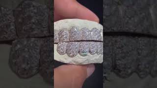 VVS1 Moissanite Diamond Iced Out Grillz grillz teeth shorts trending tiktok video viralshort [upl. by Audette166]