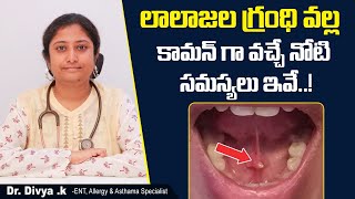 లాలాజల గ్రంధి సమస్యలు  What is Salivary Gland  Common Salivary Gland Problems  Sankhya Hospitals [upl. by Annait152]