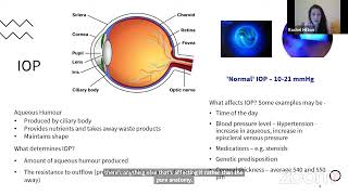 Digital glaucoma support group  Narrow angles and primary angle closure glaucoma [upl. by Leimad299]