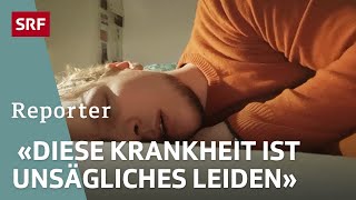 Chronisches FatigueSyndrom MECFS – Ein Albtraum für die Betroffenen  Reportage  SRF Dok [upl. by Allebasi]