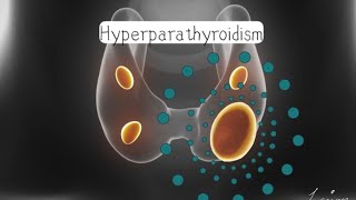 Endocrine Pathology 9 Minor Hyperparathyroidism [upl. by Tjader]